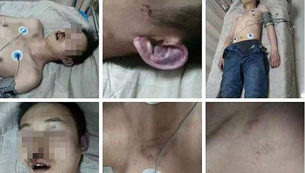 Shanxi a teenager was beaten 4-6 people in the Internet died hours no stop alarm